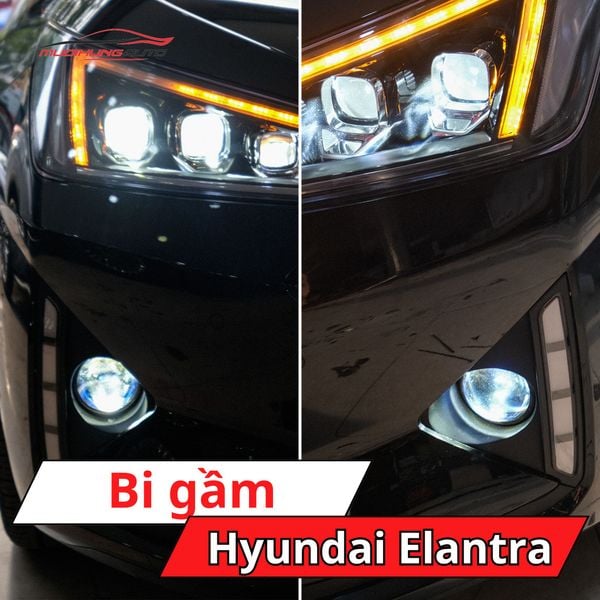 Bi Gầm Hyundai Elantra