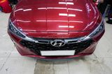 Độ Mặt Ga Lăng Cho Xe Hyundai Elantra 2019 Tại TPHCM
