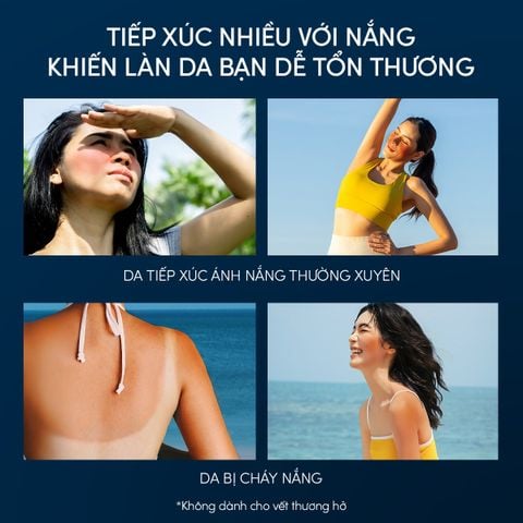  C26: DEAL 32 BACK-UP: SERUM DƯỠNG DA VÀ PHỤC HỒI TỔN THƯƠNG DA SAU NẮNG ANESSA NIGHT SUN CARE SERUM 180ML 