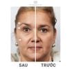 Bộ Sản Phẩm Mát Xa nâng cơ xoá nhăn da Mặt ageLOC Galvanic Spa Nu Skin