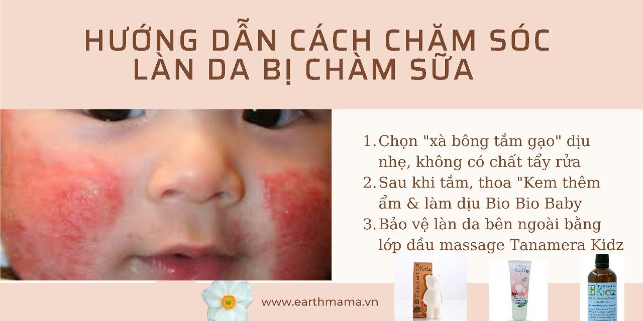  E.M  Kem làm dịu – thêm ẩm Bio Bio 100ml 