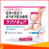 Kem trị viêm nang lông Kobayashi 30g, 20g của Nhật Bản