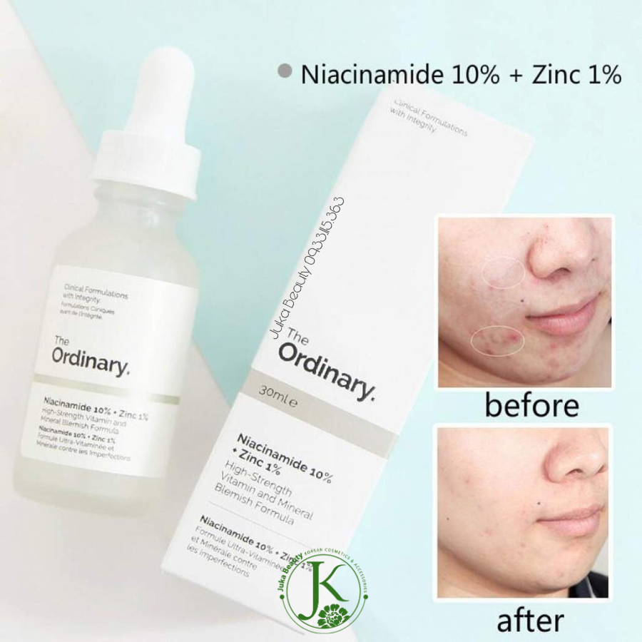  (NEW) Tinh Chất Sáng Da, Mờ Thâm Mụn The Ordinary Niacinamide 10% + Zinc 1% 