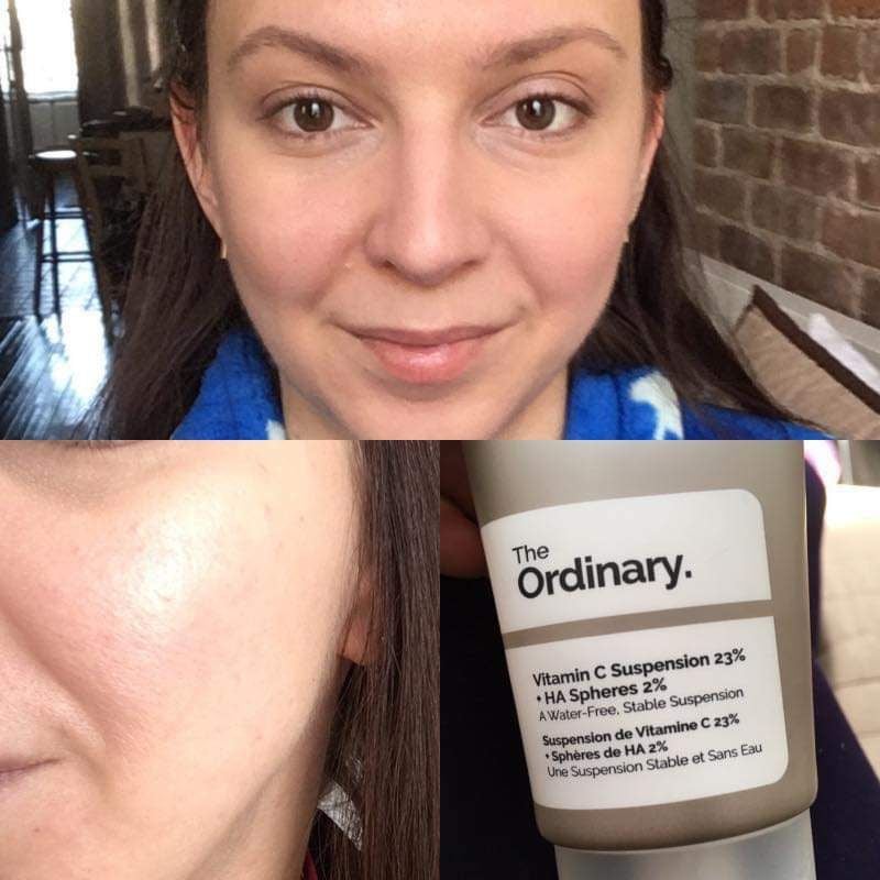  Kem dưỡng sáng da, chống lão hóa The Ordinary Vitamin C Suspension 23% + HA Spheres 2% (30ml) 