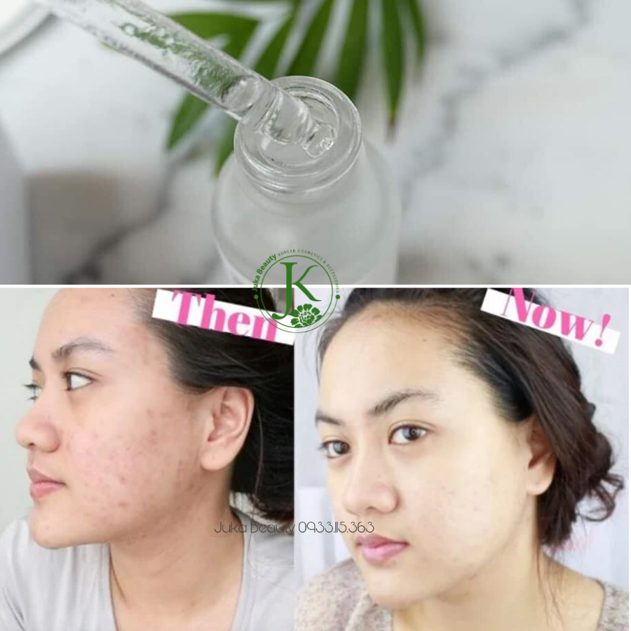  Tinh Chất Dưỡng Trắng Da Mờ Thâm The Ordinary Alpha Arbutin 2% + HA 30ml 