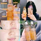  Nước Hoa Hồng Chiết Xuất Hoa Cúc Tươi SNO Calendula Herbal Phyto Toner 200ml 