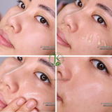  Tinh chất chống lão hóa, nâng cơ da Sur.medic+ Super Peptide 100 Collagen Lifting Serum 50ml 