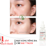  Tinh chất hỗ trợ dưỡng trắng, giảm nám Angel’s Liquid 7 Day Whitening Program Glutathione + Niacinamide Ampoule 30ml 
