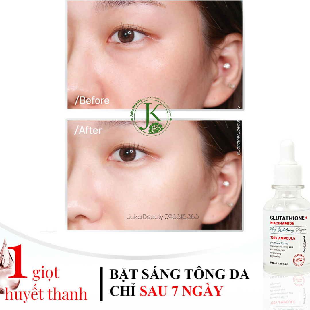  Tinh chất dưỡng trắng, trị nám Angel’s Liquid 7 Day Whitening Program Glutathione + Niacinamide 700V Ampoule 30ml 