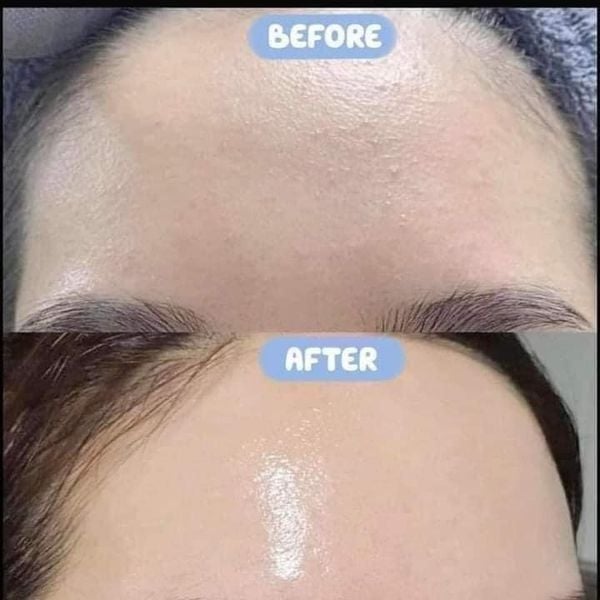  Tinh Chất Phục Hồi Và Cấp ẩm Smas Pro Vitamin B5 Hydra Serum 120g 