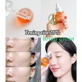  Tinh Chất Dưỡng Sáng Và Chống Oxy Hóa Bring Green Toning Vita 20% Brightening Serum 25ml (CAM) 