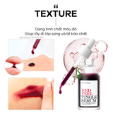  Tinh Chất Tẩy Da Chết Hóa Học So Natural Red Peel Tingle Serum 35ML 