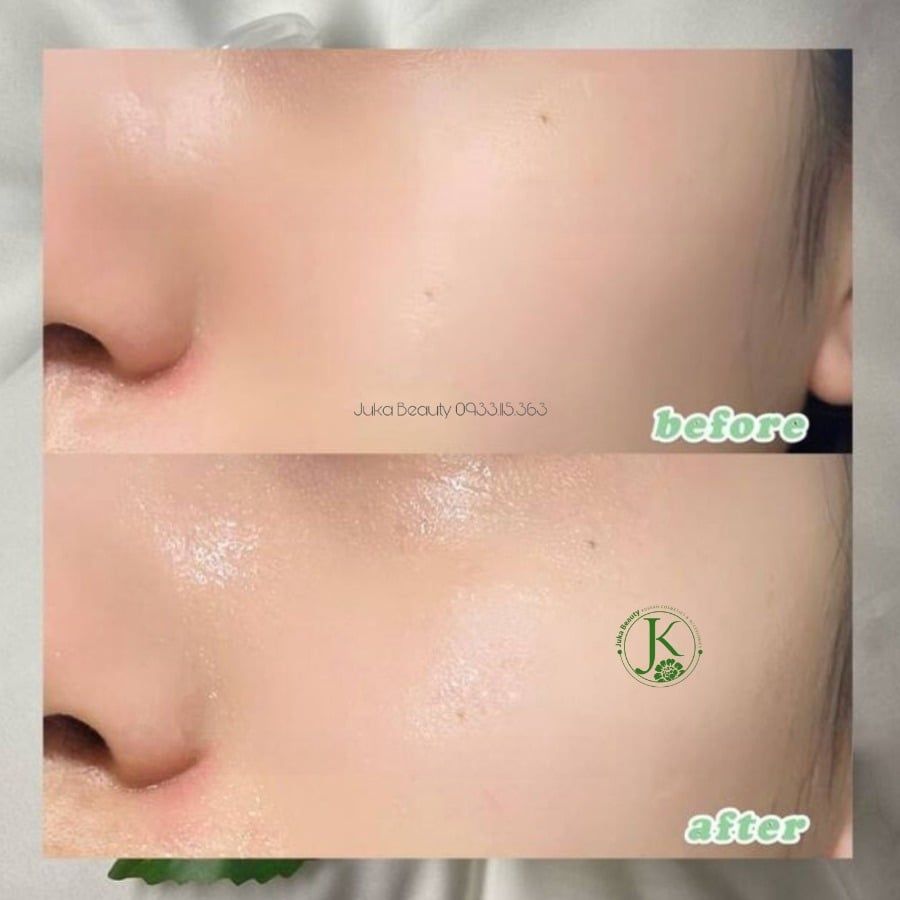  Nước Hoa Hồng Cấp ẩm Da Mụn, Nhạy Cảm Fraijour Heartleaf Blemish Toner 550ml (Trắng) 