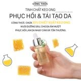  [TÁCH SET] Tinh Chất Keo Ong Phục Hồi Da CNP Laboratory Propolis Energy Active Ampule 