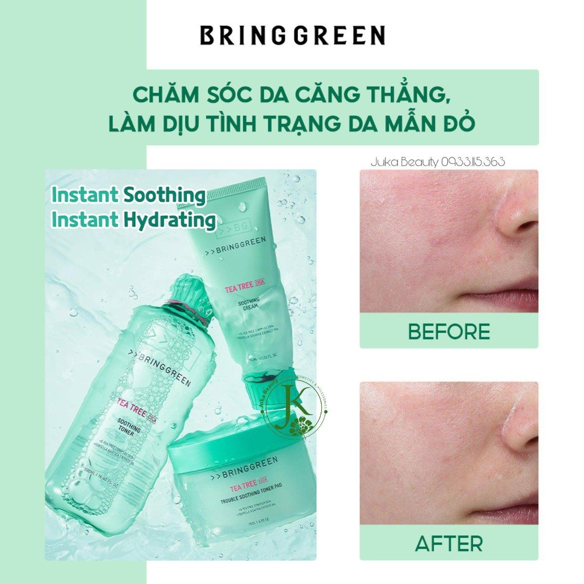  Nước Hoa Hồng Dịu Da Bring Green Tea Tree Cica Soothing Toner 250ml 