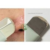  Dụng Cụ Làm Sạch Mụn Đầu Đen ILSO Deep Clean Master 