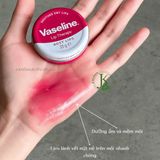  Sáp Dưỡng Môi Vaseline Lip Therapy Rosy Lip 20g 