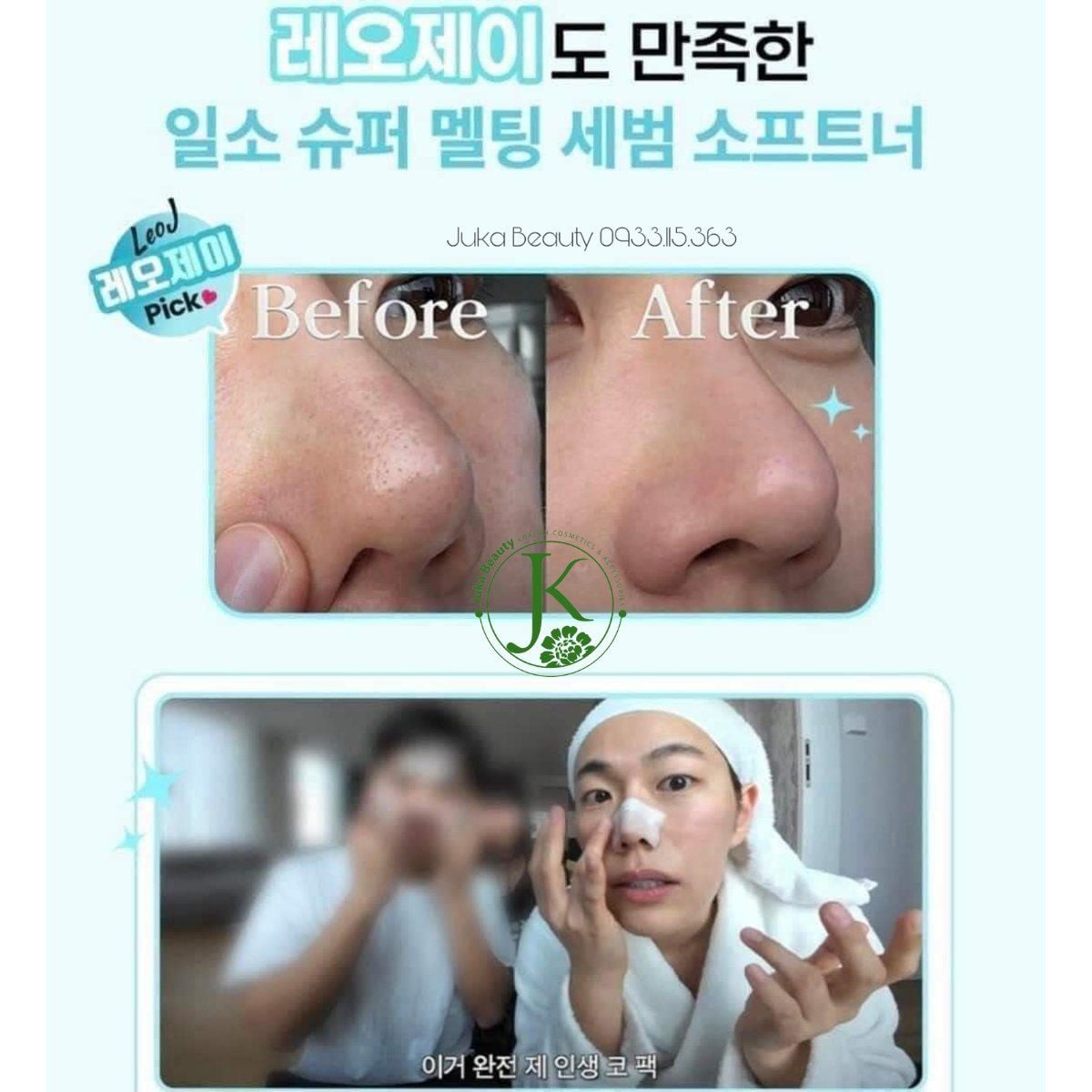  Dụng Cụ Làm Sạch Mụn Đầu Đen ILSO Deep Clean Master 