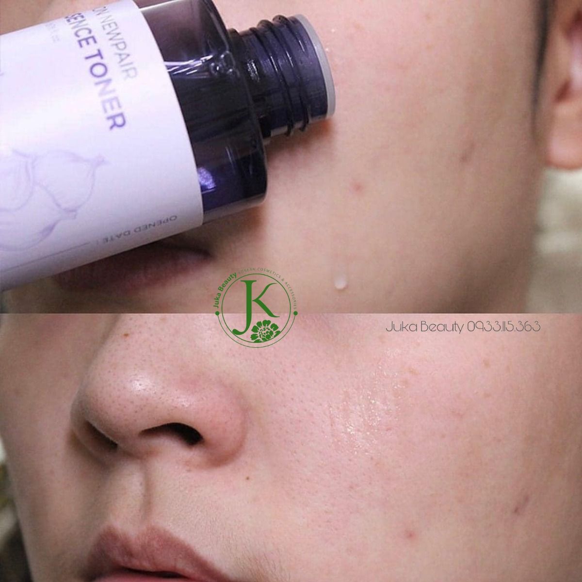  Nước Hoa Hồng Giảm Mụn, Mờ Thâm Isntree Onion Newpair Essence Toner 200ml (date t11.2025) 