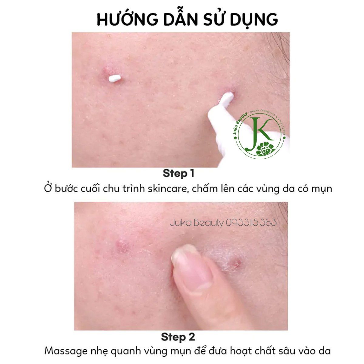  Kem Chấm Mụn Xẹp Mụn, Ngừa Thâm Tiam AC Fighting Spot RX Cream 30g 