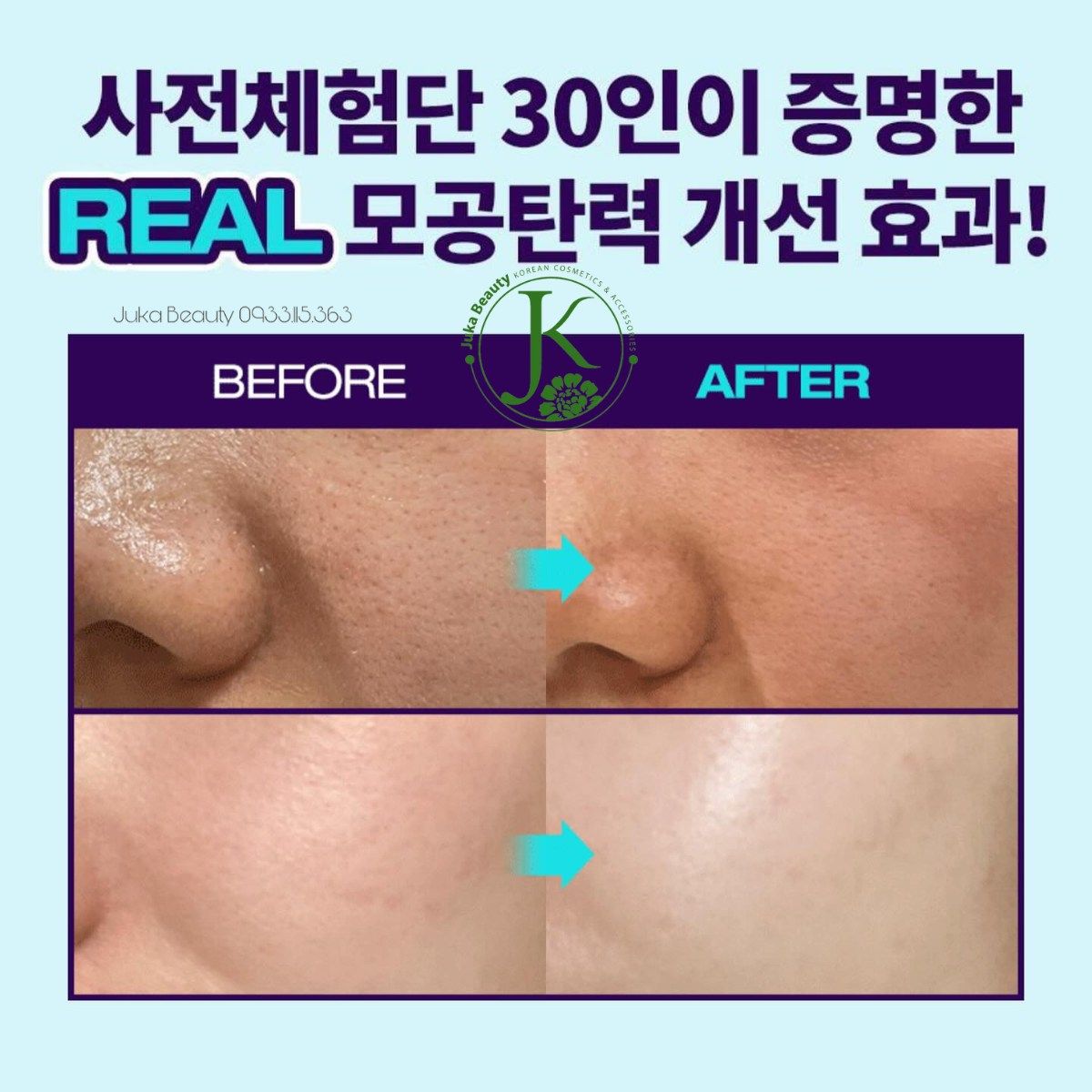  Kem Dưỡng Chống Lão Hóa DR.G R.E.D Blemish Bakuchiol 1.0% Pore Jet Cream 50ml 