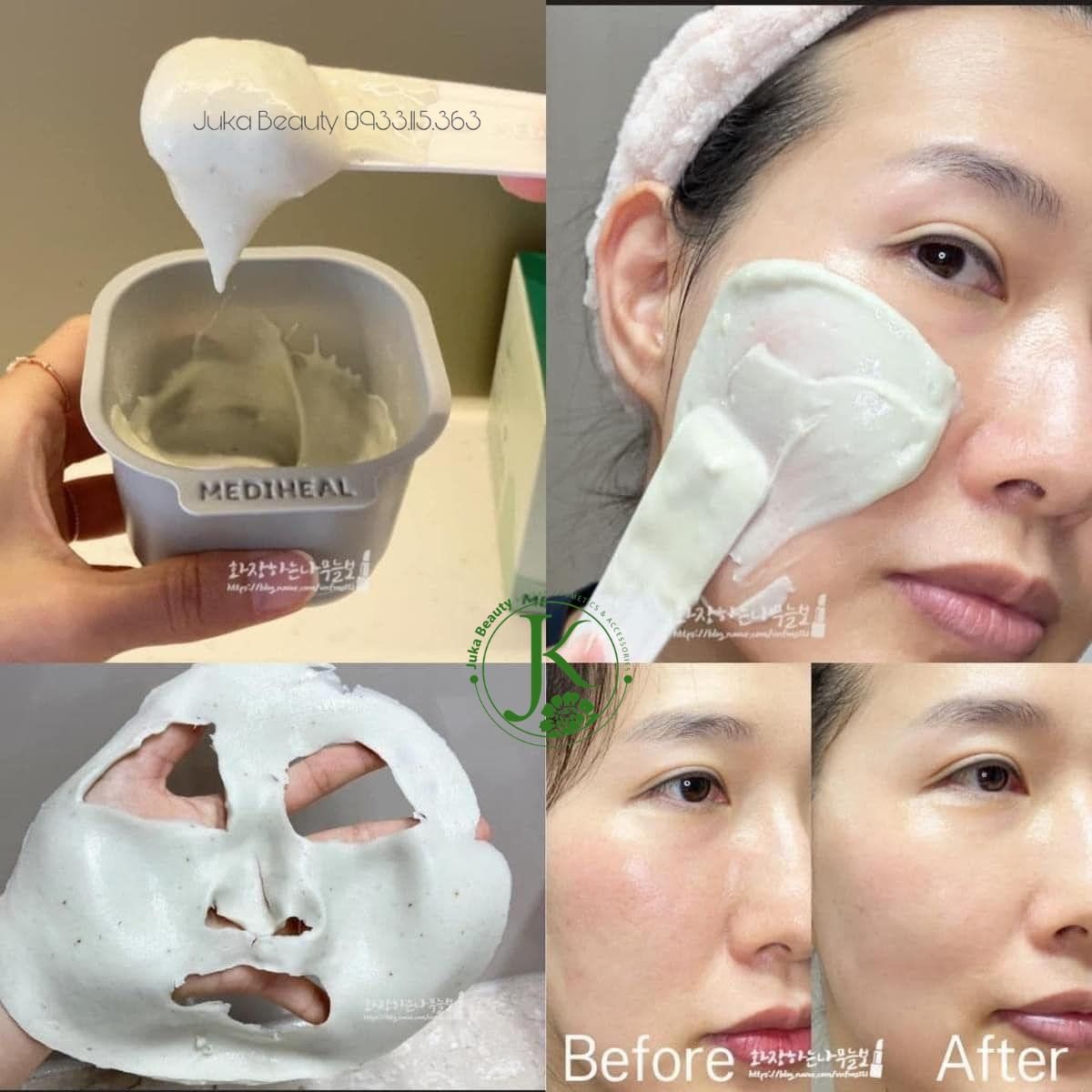 Mặt nạ thạch dẻo cấp ẩm, dịu da Mediheal Derma Modeling Pack Double Set (2 gói tinh chất, 2 gói bột) 