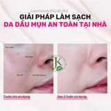  (Mẫu mới) Mặt Nạ Đất Sét Kiềm Dầu, Giảm Nhờn Derladie Vegan Pink Tox Clay Mask 60g/ 120g 