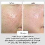  Tinh Chất Vi Kim Tái Tạo, Căng Bóng Da VT Reedle Shot 50ml 