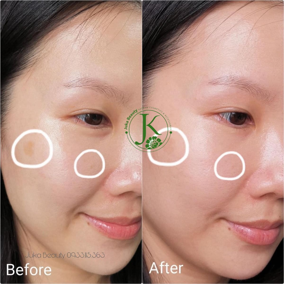  (HOT) Kem Dưỡng Trắng Da, Mờ Thâm Nám Tosowoong Arbutin 5.0 Whitening Cream 50ml 
