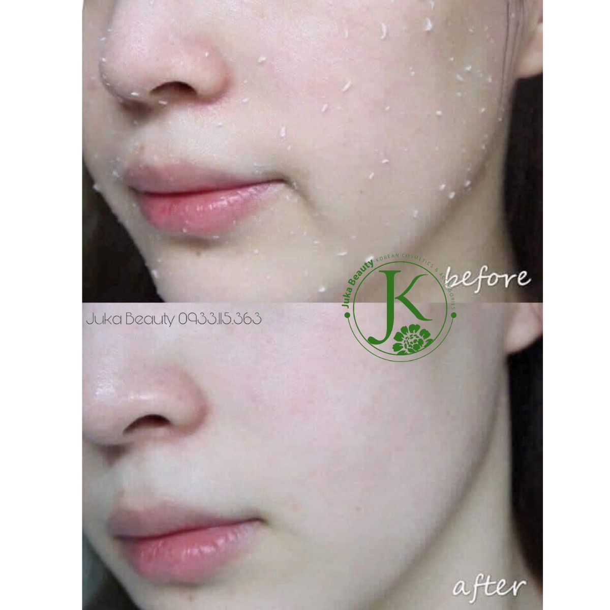  Tẩy Tế Bào Chết Dạng Gel, Sáng Da Dr.Pepti Herb Natural Peeling Gel 130ml 