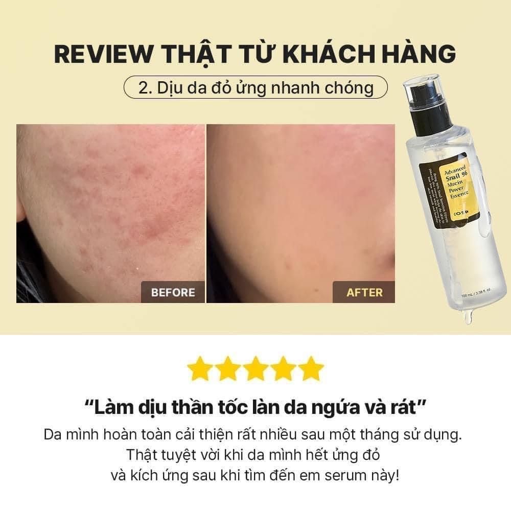  Tinh Chất Dưỡng Ẩm, Tái Tạo, Phục Hồi Da Cosrx Advanced Snail 96 Mucin Power Essence 100ml  (HSD T12/2026) 
