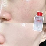  Viên Uống Trắng Da Angel's Liquid Glutathione Oneday Collagen 600mgx72 Viên 