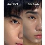  Tinh Chất Cấp Ẩm L'Oréal LOREAL Revitalift 1.5% Hyaluronic Acid Replumping Serum 30ml 