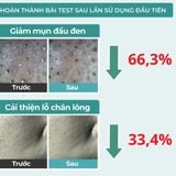  Tinh chất ủ mụn, giảm mụn đầu đen Jumiso Blackhead Melting Softener Special Kit 150ml 