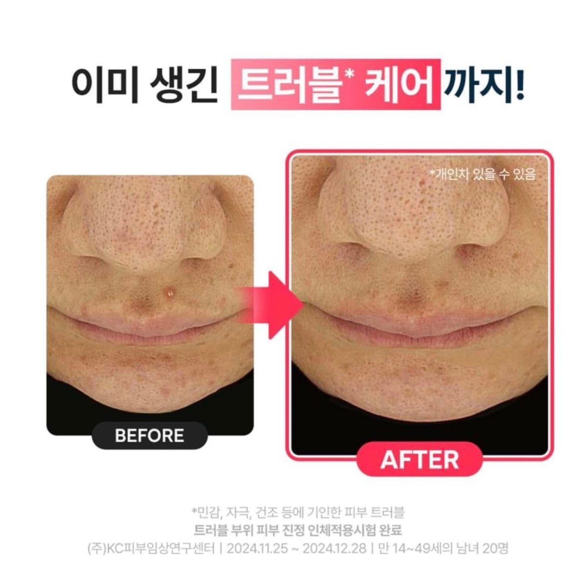  Tinh Chất dưỡng ẩm DR.G R.E.D Blemish Clear Hyal Cica Soothing Serum 50ml 