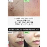  Mặt Nạ 2 Bước Dưỡng Sáng, Trẻ Hóa, Mịn Da VT Reedle Shot (100 & 300 & 700) 