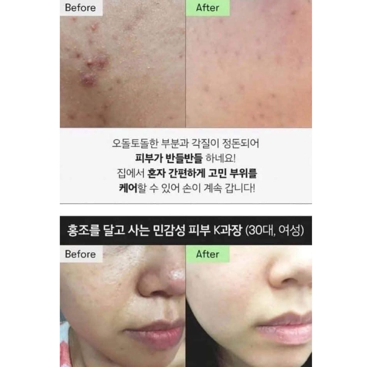  Mặt Nạ 2 Bước Dưỡng Sáng, Trẻ Hóa, Mịn Da VT Reedle Shot (100 & 300 & 700) 