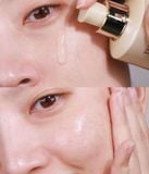  Tinh Chất Dưỡng ẩm, Ngừa Lão Hóa The Whoo Bichup Ultimate Recovery Youth Serum 20ml 