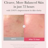  Tinh Chất Medicube Dưỡng Sáng Mờ Thâm Medicube TXA Niacinamide 15 Serum 30ml 