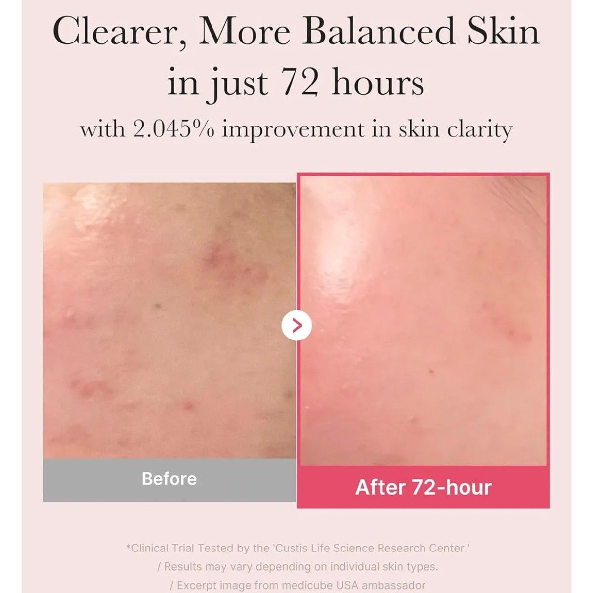  Tinh Chất Medicube Dưỡng Sáng Mờ Thâm Medicube TXA Niacinamide 15 Serum 30ml 
