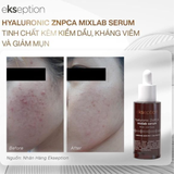  Tinh Chất Giảm Mụn, Kiềm Dầu Ekseption Hyaluronic ZNPCA Mixlab Serum 75ml 