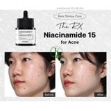  Tinh Chất Chăm Sóc Da Mụn Toàn Diện Cosrx The Niacinamide 15 Serum 20ml 