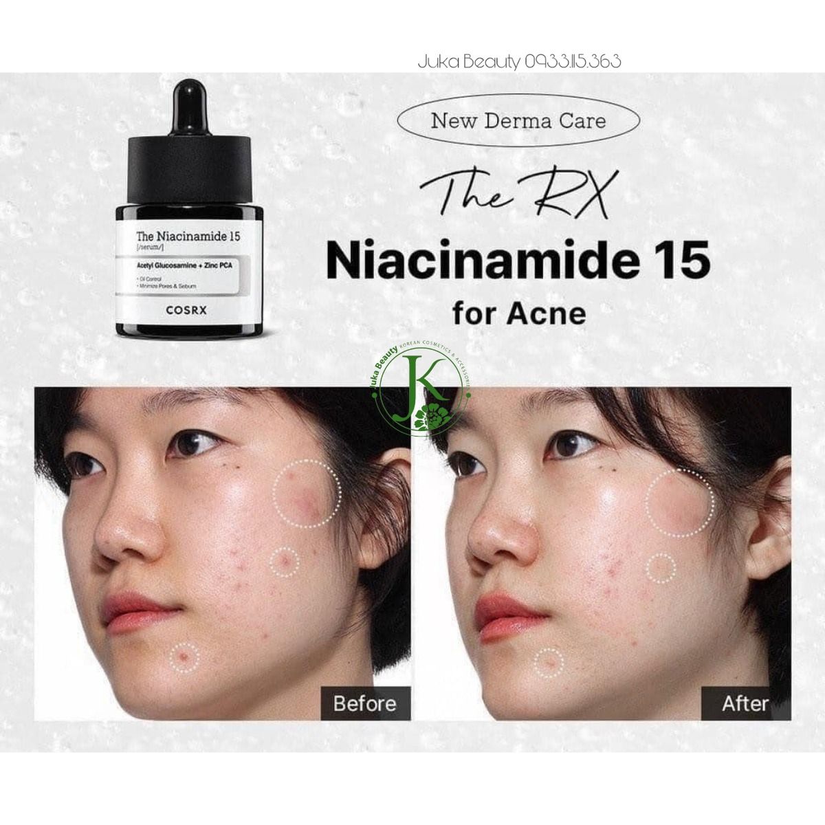  Tinh Chất Chăm Sóc Da Mụn Toàn Diện Cosrx The Niacinamide 15 Serum 20ml 