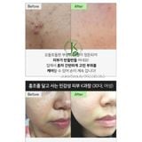  Tinh Chất Vi Kim Tái Tạo, Căng Bóng Da VT Reedle Shot 50ml 