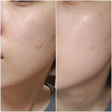  Kem Chống Nắng Skin1004 Madagascar Centella Air-fit Suncream Plus SPF50+ PA++++ 50ml 