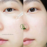  Tinh Chất Rau Má, Giảm Mụn PrettySkin The Pure Jeju Cica 80 Ampoule 50ml 