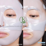  (XANH DƯƠNG) Mặt Nạ Thạch Cải Thiện Độ Đàn Hồi Da MediAnswer Pore Collagen Mask 37g 