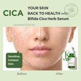  Tinh Chất Rau Má, Phục Hồi Da Manyo Bifida Cica Herb Serum 50ml 