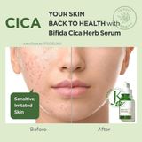  Tinh Chất Rau Má Phục Hồi Da Ma:nyo Bifida Cica Herb Serum 50ml 