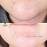  Miếng Bông Dưỡng ẩm, Sáng Da Mediheal Vitamide Brightening Pad 180ml (100 miếng) 